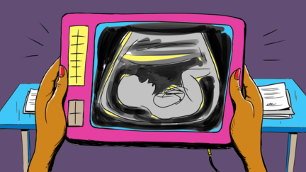 Diagnóstico prenatal & derechos de los padres