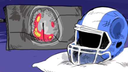 Lesiones cerebrales y el futbol americano