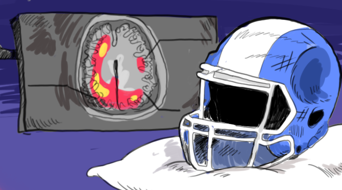 NFL hopes to reduce head injuries with helmet experiment